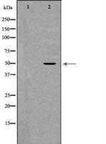 CADM1 Antibody in Western Blot (WB)