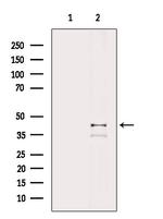 PDHA1 Antibody in Western Blot (WB)