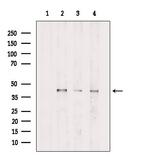 PDHA1 Antibody in Western Blot (WB)