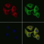 IL1R2 Antibody in Immunocytochemistry (ICC/IF)