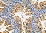 GPX4 Antibody in Immunohistochemistry (Paraffin) (IHC (P))