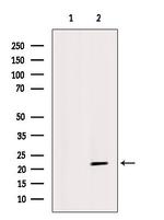 GPX4 Antibody in Western Blot (WB)