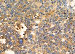 RCAS1 Antibody in Immunohistochemistry (Paraffin) (IHC (P))