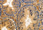 RCAS1 Antibody in Immunohistochemistry (Paraffin) (IHC (P))