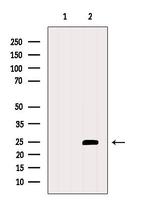 RCAS1 Antibody in Western Blot (WB)