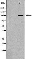 GluR6 Antibody in Western Blot (WB)