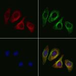 Glypican 3 Antibody in Immunocytochemistry (ICC/IF)