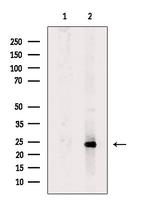 PSMD10 Antibody in Western Blot (WB)