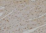 UBE2D1 Antibody in Immunohistochemistry (Paraffin) (IHC (P))