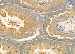 UBE2D1 Antibody in Immunohistochemistry (Paraffin) (IHC (P))