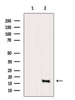 UBE2D1 Antibody in Western Blot (WB)