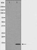 MSMB Antibody in Western Blot (WB)