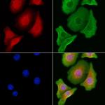 HSD17B2 Antibody in Immunocytochemistry (ICC/IF)