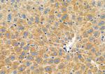 HSD17B2 Antibody in Immunohistochemistry (Paraffin) (IHC (P))