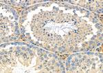 HSD17B2 Antibody in Immunohistochemistry (Paraffin) (IHC (P))