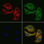 CDA Antibody in Immunocytochemistry (ICC/IF)