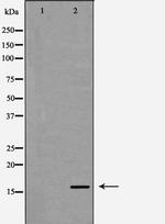 RPS19 Antibody in Western Blot (WB)