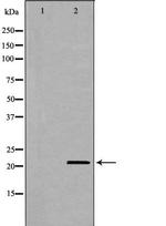 CD70 Antibody in Western Blot (WB)