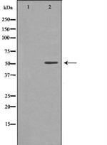 EPHX1 Antibody in Western Blot (WB)