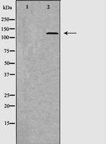 Thrombospondin 1 Antibody in Western Blot (WB)