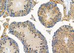 GAS2L1 Antibody in Immunohistochemistry (Paraffin) (IHC (P))