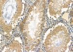 GAS2L1 Antibody in Immunohistochemistry (Paraffin) (IHC (P))