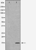 SPINLW1 Antibody in Western Blot (WB)