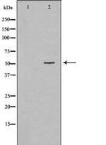 HCLS1 Antibody in Western Blot (WB)