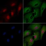 MDA5 Antibody in Immunocytochemistry (ICC/IF)