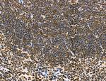 MDA5 Antibody in Immunohistochemistry (Paraffin) (IHC (P))