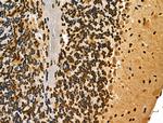 MDA5 Antibody in Immunohistochemistry (Paraffin) (IHC (P))