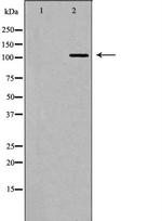 MDA5 Antibody in Western Blot (WB)