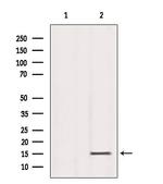 H3K79me3 Antibody in Western Blot (WB)