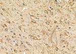 SIAH1 Antibody in Immunohistochemistry (Paraffin) (IHC (P))