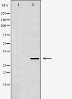 SIAH1 Antibody in Western Blot (WB)