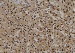 NUP62 Antibody in Immunohistochemistry (Paraffin) (IHC (P))