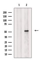 NUP62 Antibody in Western Blot (WB)