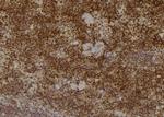 PSMA2 Antibody in Immunohistochemistry (Paraffin) (IHC (P))