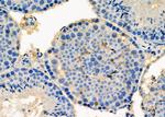 PSMA2 Antibody in Immunohistochemistry (Paraffin) (IHC (P))