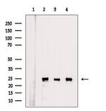 PSMA2 Antibody in Western Blot (WB)