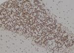 PSMC4 Antibody in Immunohistochemistry (Paraffin) (IHC (P))