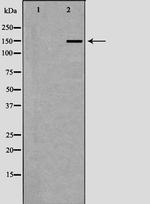 TCOF1 Antibody in Western Blot (WB)