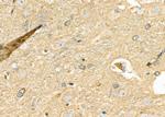 DKK3 Antibody in Immunohistochemistry (Paraffin) (IHC (P))