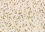 PCBP2 Antibody in Immunohistochemistry (Paraffin) (IHC (P))