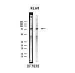 SLP76 Antibody in Western Blot (WB)