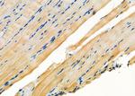 NDUFS1 Antibody in Immunohistochemistry (Paraffin) (IHC (P))