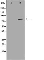 NDUFS1 Antibody in Western Blot (WB)