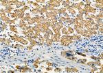 ALDH4A1 Antibody in Immunohistochemistry (Paraffin) (IHC (P))