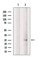 CLEC4D Antibody in Western Blot (WB)