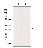 DLK1 Antibody in Western Blot (WB)